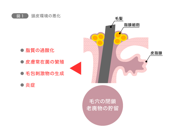 図1　頭皮環境の悪化