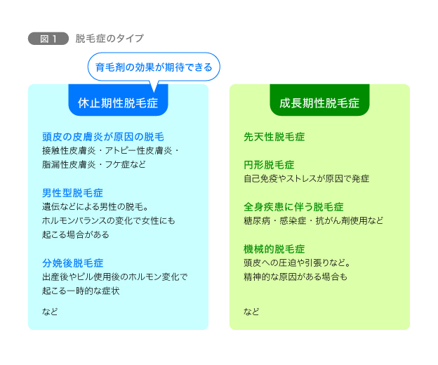 図1　脱毛症のタイプ